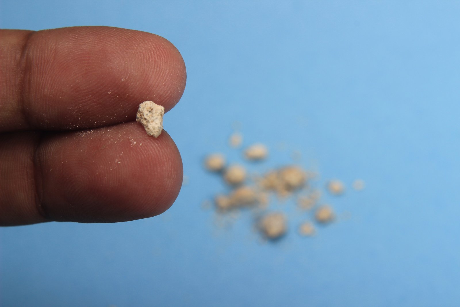 Kidney Stone Doctor In Mandla